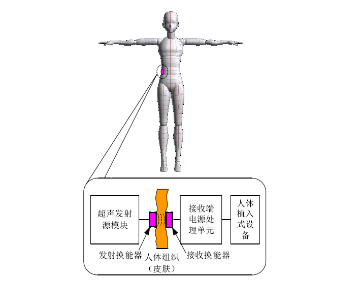 植入式醫療設備超聲波耦合無線電能傳輸模型.png 植入式醫療設備超聲波耦合無線電能傳輸模型.png